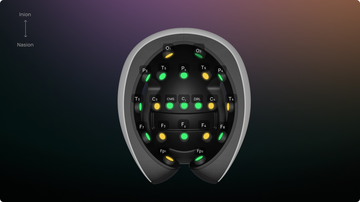 electrodes_names.png